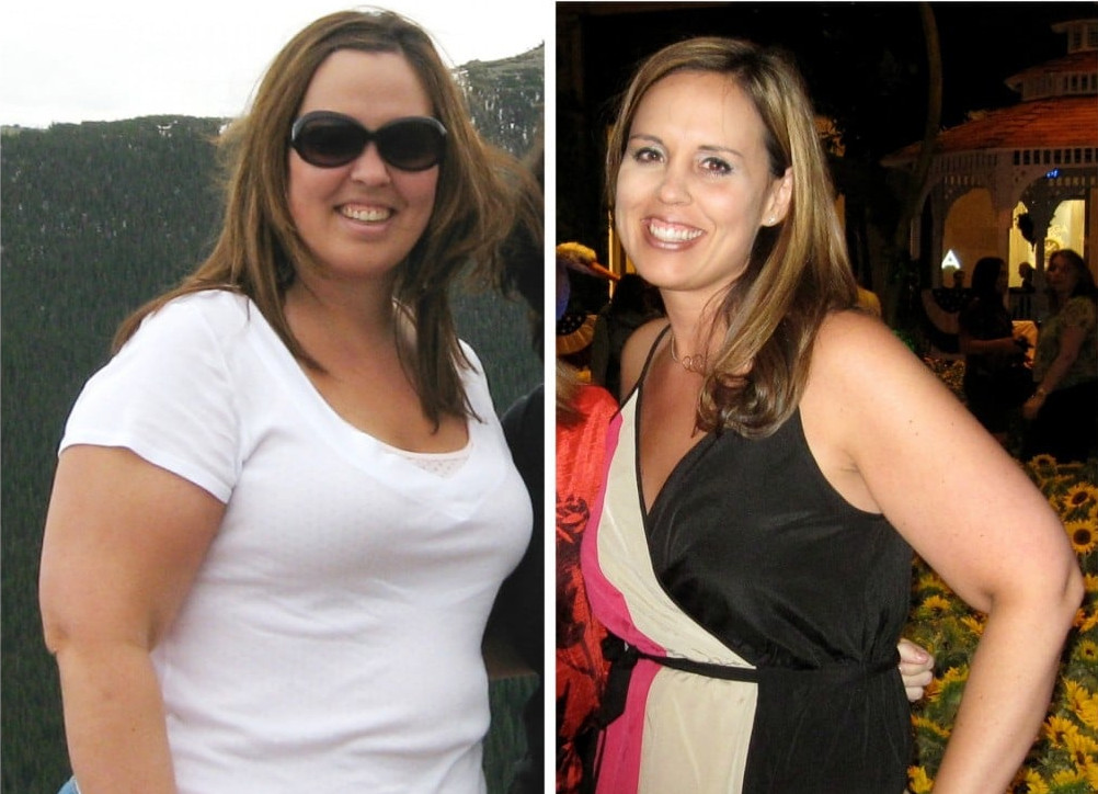 Before-After